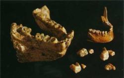 Челюст със зъби на мегантроп (вляво) и съвременен човек